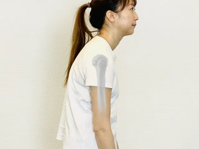 猫背・巻き肩で起こる頭痛、肩こり、腰痛